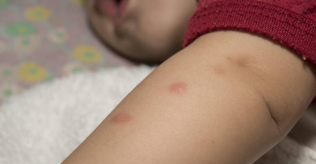 Bien que rare, les effets de Zika peuvent avoir des effets néfastes sur les enfants et les adultes.