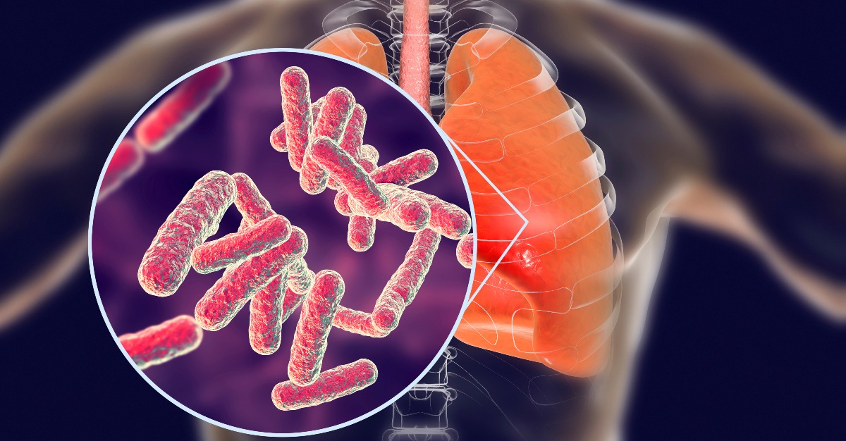 Rather than bacteria, it appears viruses are the root of pneumonia.