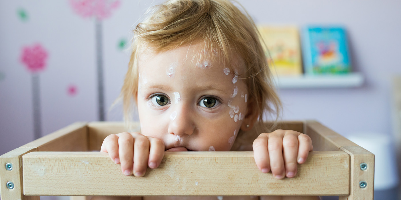 Chickenpox can be a very dangerous disease. Ensure your family is protected.
