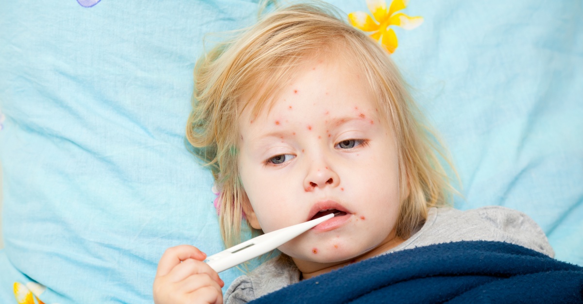Medicine like ibuprofen can have serious side effects for a person sick with chickenpox.