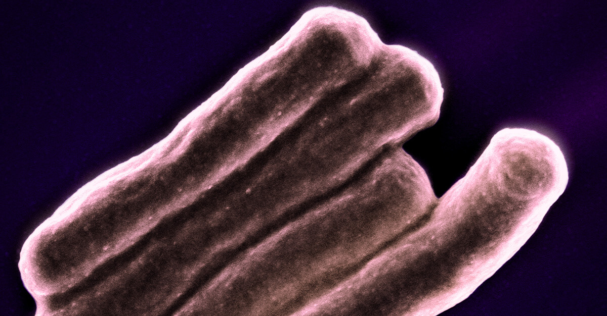 TB is becoming a greater risk in many parts of the world.