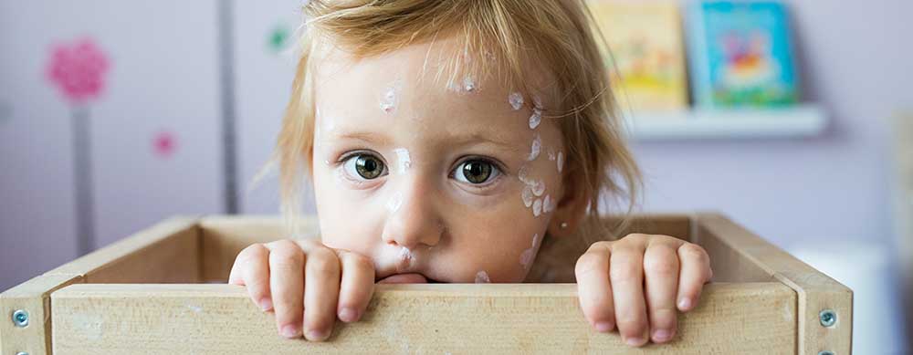Chickenpox can be a very dangerous disease. Ensure your family is protected.
