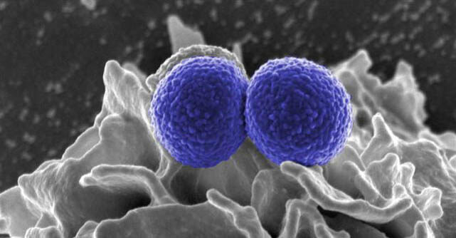 Magnified blue-colored bacterial clusters on tissue surface